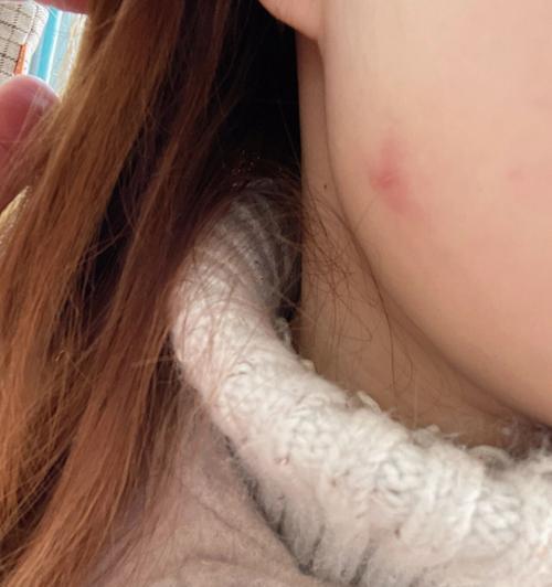 猫咪身上的细菌（探索猫咪身上的常见细菌，保护你和你的宠物的健康）