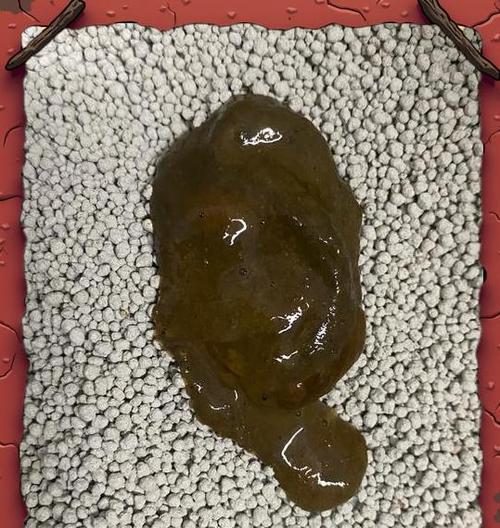 猫咪肠道菌群异常的危害与解决方案（了解肠道菌群的重要性，有效预防猫咪疾病）